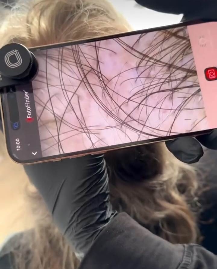 Консультація трихолога